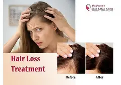 Top Hair Loss Treatment in Bangalore: Regain Your Confidence!